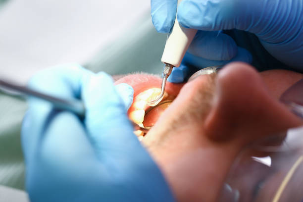Best Emergency Broken Tooth Repair in Zephyrhills North, FL